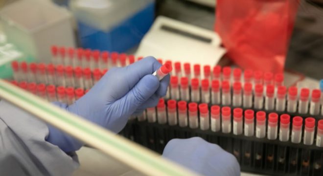 Sete países europeus iniciam testes de remédios contra o novo coronavírus