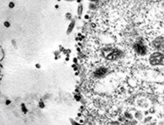 estudo inédito mostra ação do vírus nas células humanas
