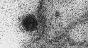 Coronavírus: estudo inédito mostra ação do vírus nas células humanas
