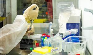 Pesquisadores de Hong Kong detectam primeiro caso de reinfecção por coronavírus