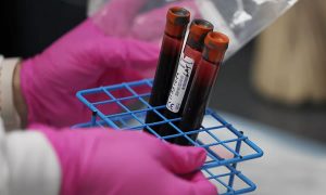 OMS vai disponibilizar 120 milhões de testes rápidos de Covid-19 para de baixa e média renda