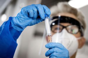 Anvisa inicia análise do primeiro pedido de registro de vacina contra a Covid-19 no Brasil