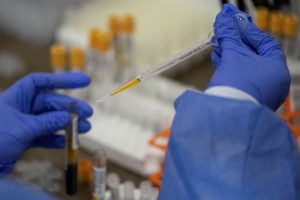 Anvisa fará análise parcial de dados de vacina da Janssen contra Covid-19