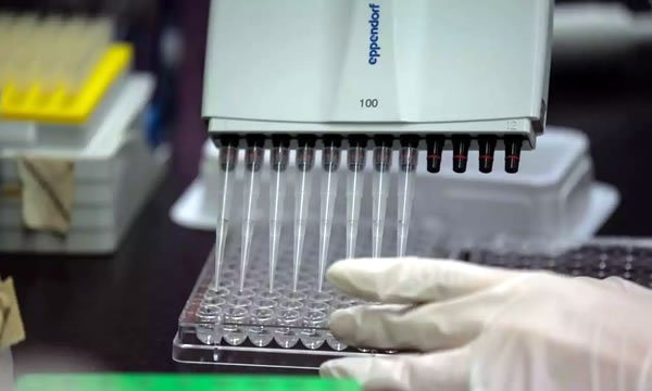 Casos de coronavírus no mundo somam mais de 55 milhões, aponta Johns Hopkins