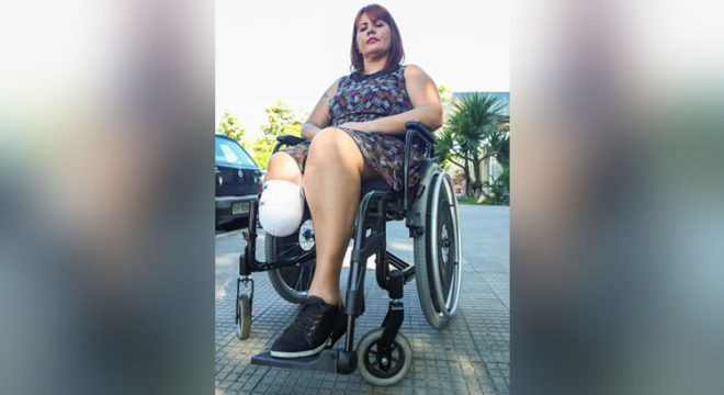 Governo do Ceará lança programa para mapear pessoas com deficiência