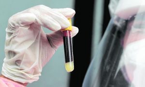 150 cidades do Ceará têm risco de médio a altíssimo de incidência da Covid-19