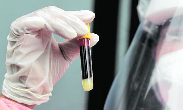 150 cidades do Ceará têm risco de médio a altíssimo de incidência da Covid-19