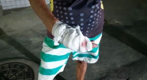 Mulher fere companheiro com golpes de faca durante discussão