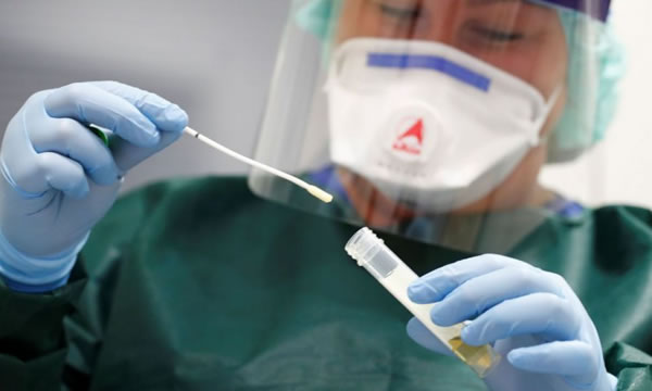 Ceará investiga 183 casos de pessoas que testaram positivo para Covid-19 duas vezes