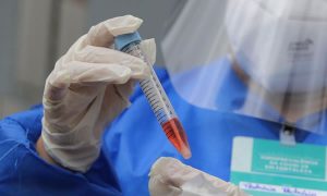 Secretaria da Saúde registra aumento de casos de Covid-19 em 4 das 5 regiões do Ceará