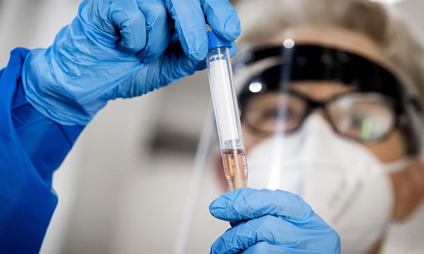 Ministério Público pede informações sobre plano de vacinação à Sesa e SMS