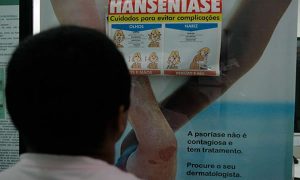 Juazeiro do Norte e outros dois municípios estão sem medicamento para tratar hanseníase