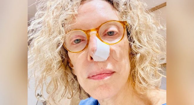 Apresentadora Marília Gabriela passa por cirurgia após diagnóstico de câncer de pele