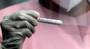 Ceará é o estado que tem mais amostras com mutação de variante brasileira, diz Fiocruz