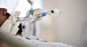 Mortes por Covid e síndrome respiratória fora de UTIs crescem 8 vezes entre janeiro e março no Ceará