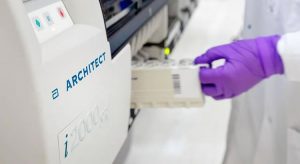 Ceará contrata laboratório para fornecer 30 mil testes rápidos de Covid-19