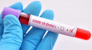 Ceará identifica quatro primeiros casos de variante delta do coronavírus no estado