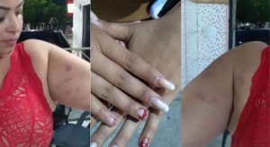 Digital influencer denuncia agressões de ex-marido, no Ceará