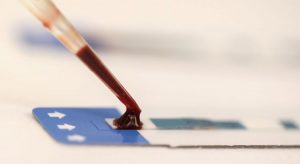 Pesquisadores desenvolvem nova abordagem para combater vírus da Aids