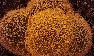 Fiocruz Ceará já tem capacidade de detectar variante Ômicron, diz Sesa