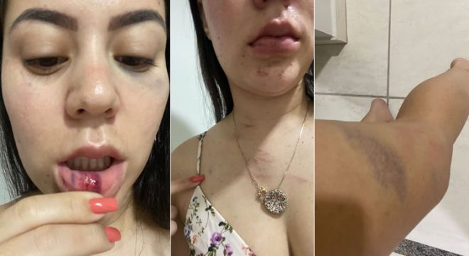 Jovem denuncia ex por agressão em Barbalha e incentiva outras mulheres: 'Vocês podem denunciar'