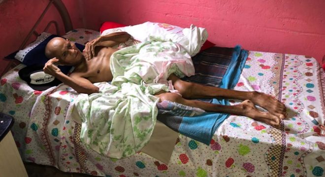 Em Barbalha, homem de 49 anos está acamado há 6 meses e família pede ajuda