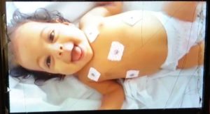 Bebê de 4 meses precisa realizar transplante de fígado e familiares pedem apoio