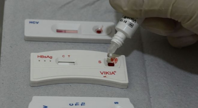 Edital de seleção de pesquisadores atuantes no combate à sífilis é aberto no Ceará