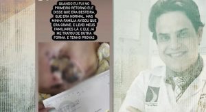 Mulheres denunciam médico que atende celebridades por sequelas após cirurgias plásticas, no Ceará