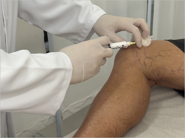 Médico aplicando substância em varizes.