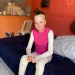 Jovem do Crato busca doações para tratamento de doença rara