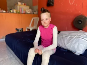 Jovem do Crato busca doações para tratamento de doença rara