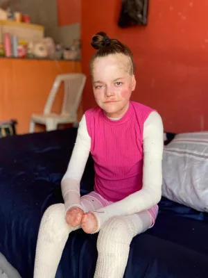 Jovem do Crato busca doações para tratamento de doença rara