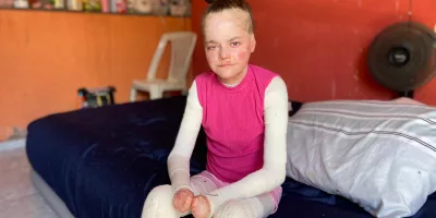 Jovem do Crato busca doações para tratamento de doença rara