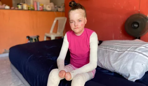 Jovem do Crato busca doações para tratamento de doença rara