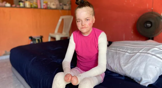 Jovem do Crato busca doações para tratamento de doença rara